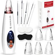 Recensioni di xpreen aspiratore punti neri